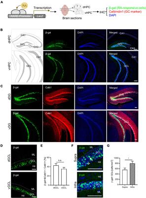 Retinoic acid modulation of granule cell activity and spatial discrimination in the adult hippocampus